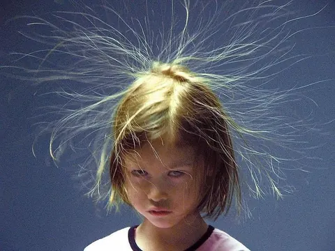 Photo of a girl with static electricity making her hair stand up in fine strands.
